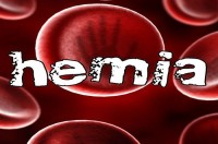 zdjęcie: hemia.jpg